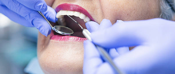 Best Dentist for Tooth Abscess  in Greensboro, MD