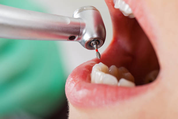 Best Broken Tooth Emergency  in Greensboro, MD